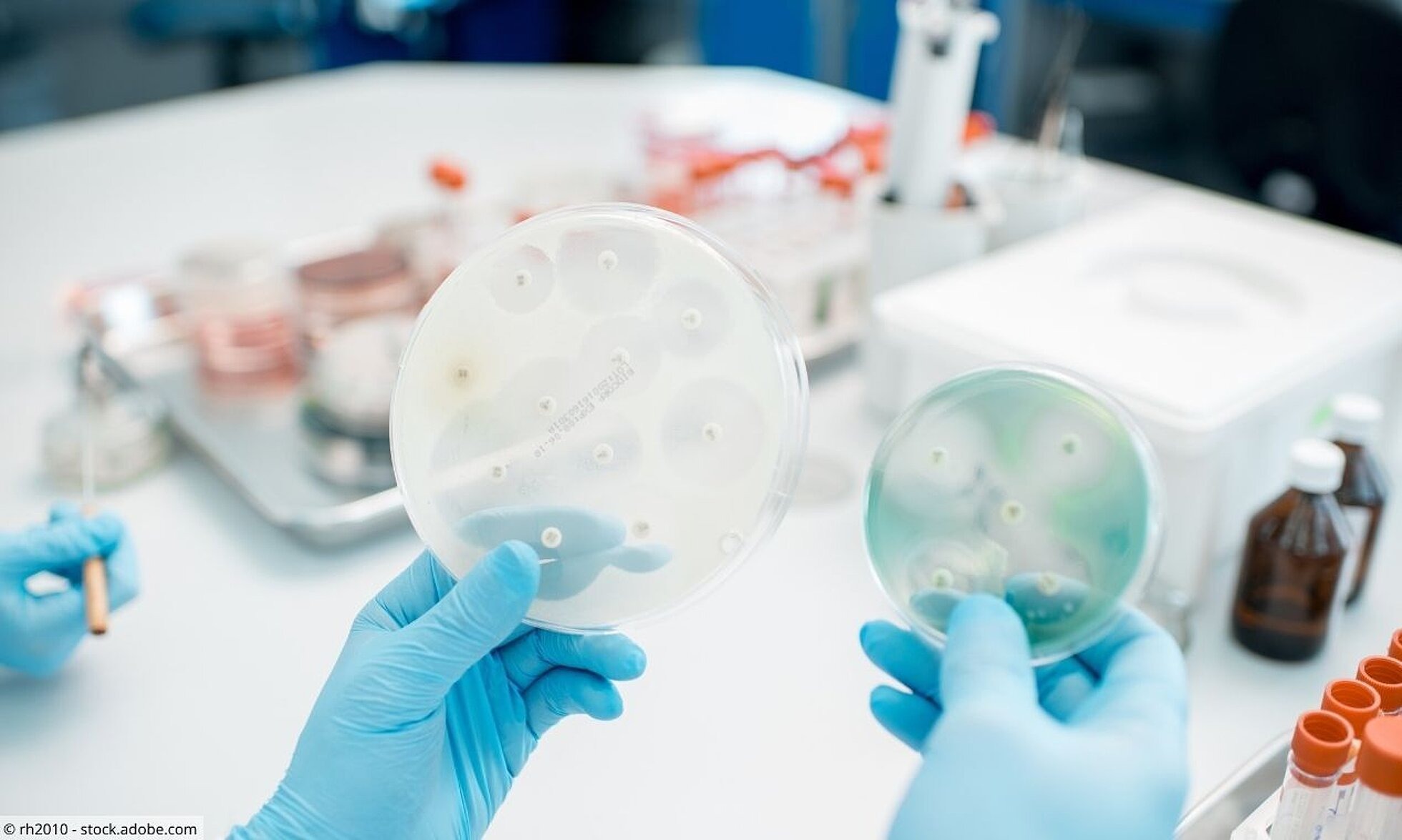 Antibiotikaresistenzen Petrischalen mit Bakterienkulturen